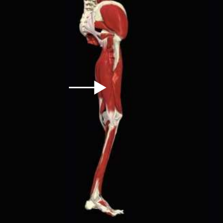 Biceps femoris – long head