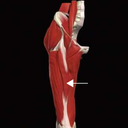 Rectus femoris
