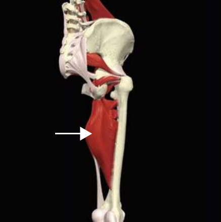 Adductor magnus, posterior fibers