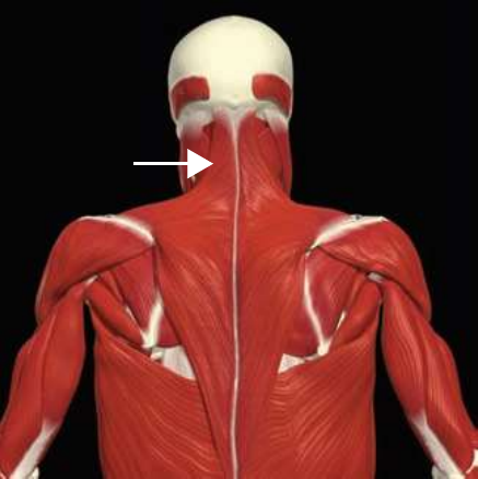 Upper trapezius