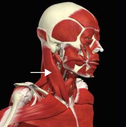 Sternocleidomastoid