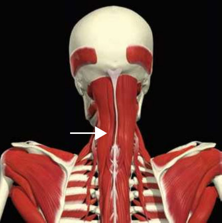 Iliocostalis: cervicus division