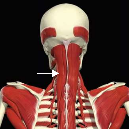 Spinalis: capitis division