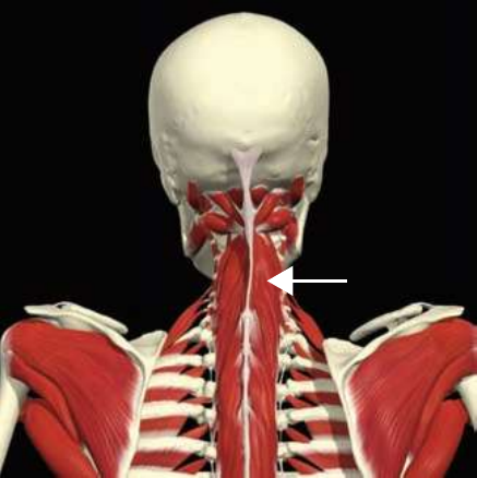 Spinalis: cervicus division