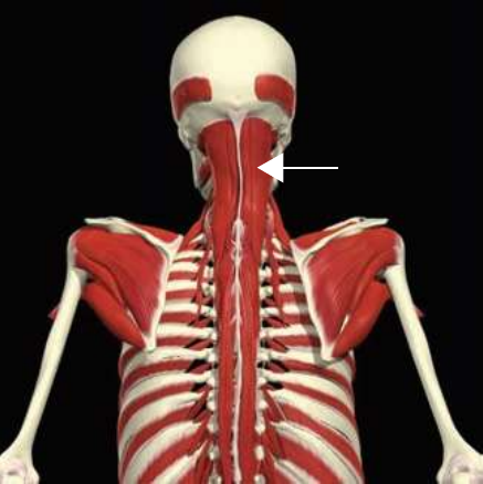 Transversospinalis: capitus division