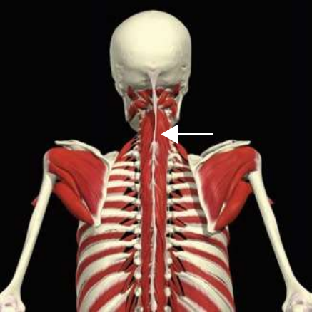 Transversospinalis: cervicis division