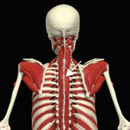 Transversospinalis: thoracis division