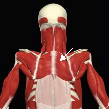 Rhomboid major and minor highlighted between the spine and scapula