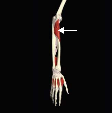 Supinator