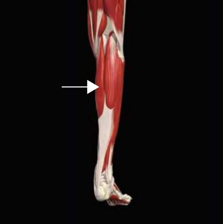 Gastrocnemius anatomy