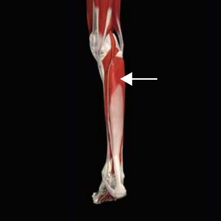 Soleus anatomy