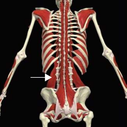 Quadratus lumborum highlighted on the posterior abdominal wall