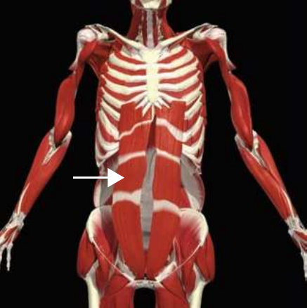 Rectus abdominis highlighted on the anterior abdominal wall
