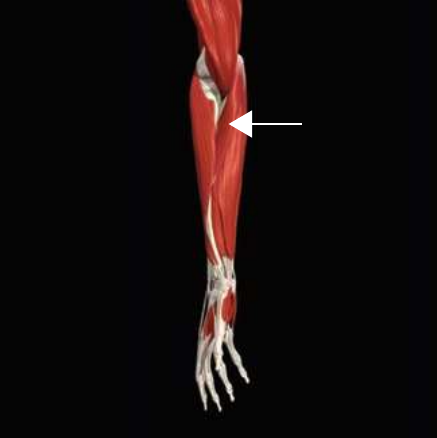 Pronator teres highlighted on the forearm musculature