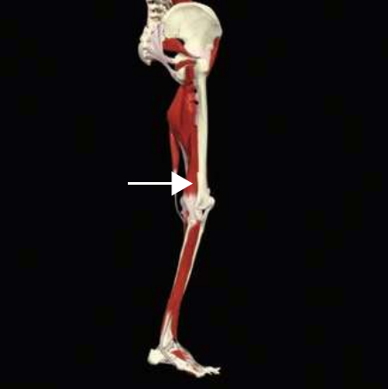 Short head of biceps femoris