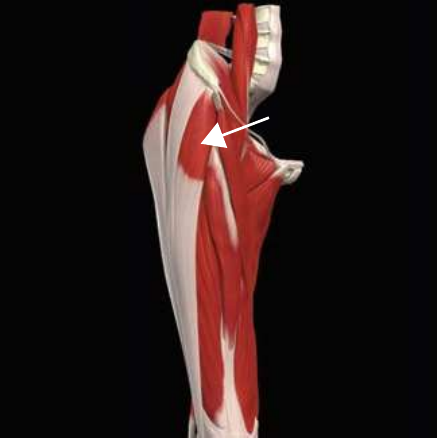 Tensor fasciae latae