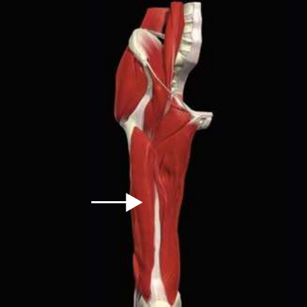 Vastus intermedius, the deepest quadriceps head, lying against the femur